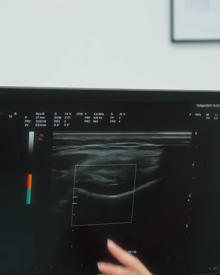 Fisioterapia invasiva